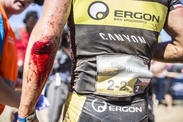 Kristian Hynek of team Topeak Ergon Racing after a crash during stage 3 of the 2016 Absa Cape Epic Mountain Bike stage race held from Saronsberg Wine Estate in Tulbagh to the Cape Peninsula University of Technology in Wellington, South Africa on the 16th March 2016 Photo by Nick Muzik/Cape Epic/SPORTZPICS 